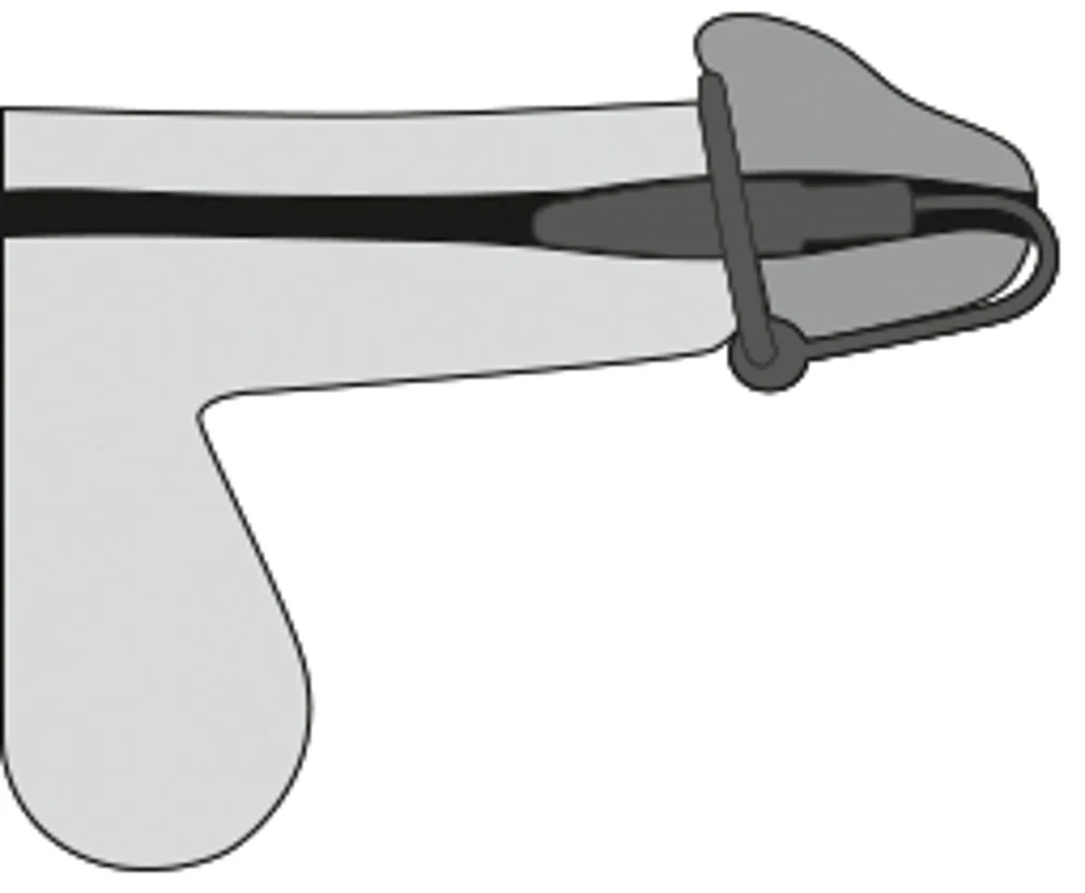 Penisplug with a silicone glans ring harnröhrenstimulation