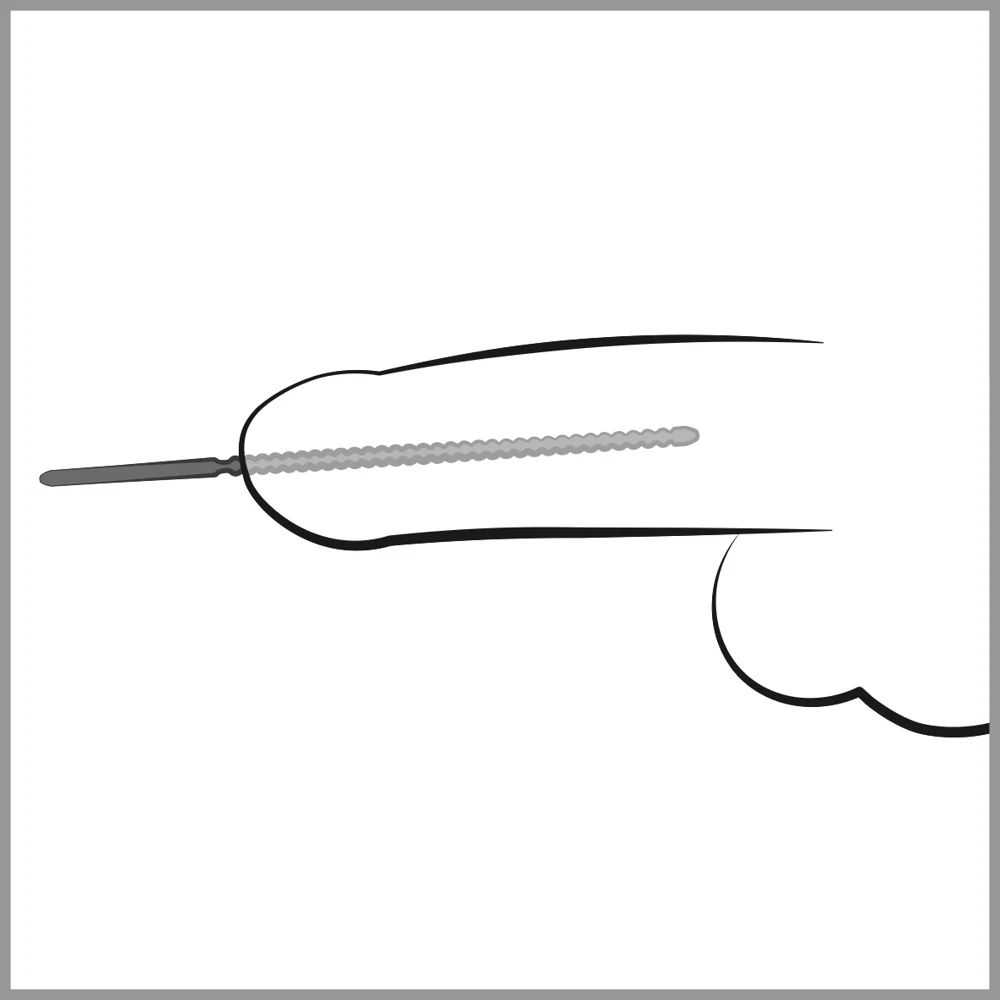 Penisplug Dip Stick Ripped Ø 6 mm harnröhrenstimulation