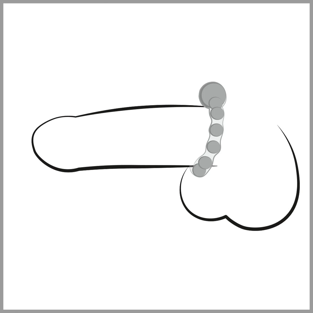 NMC Maximum Metal Ring penisring